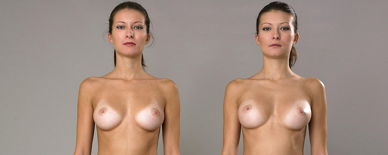 polya-yulia-splitting-image-nude-twins-sisters-tan-lines-hegre-art-mini